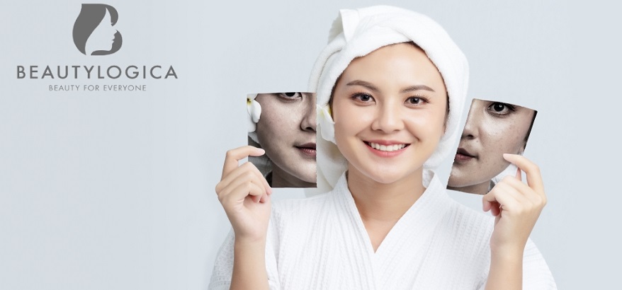 Buat Harimu Makin Percaya Diri Dengan Perawatan Maksimal di Klinik Kecantikan Beautylogica